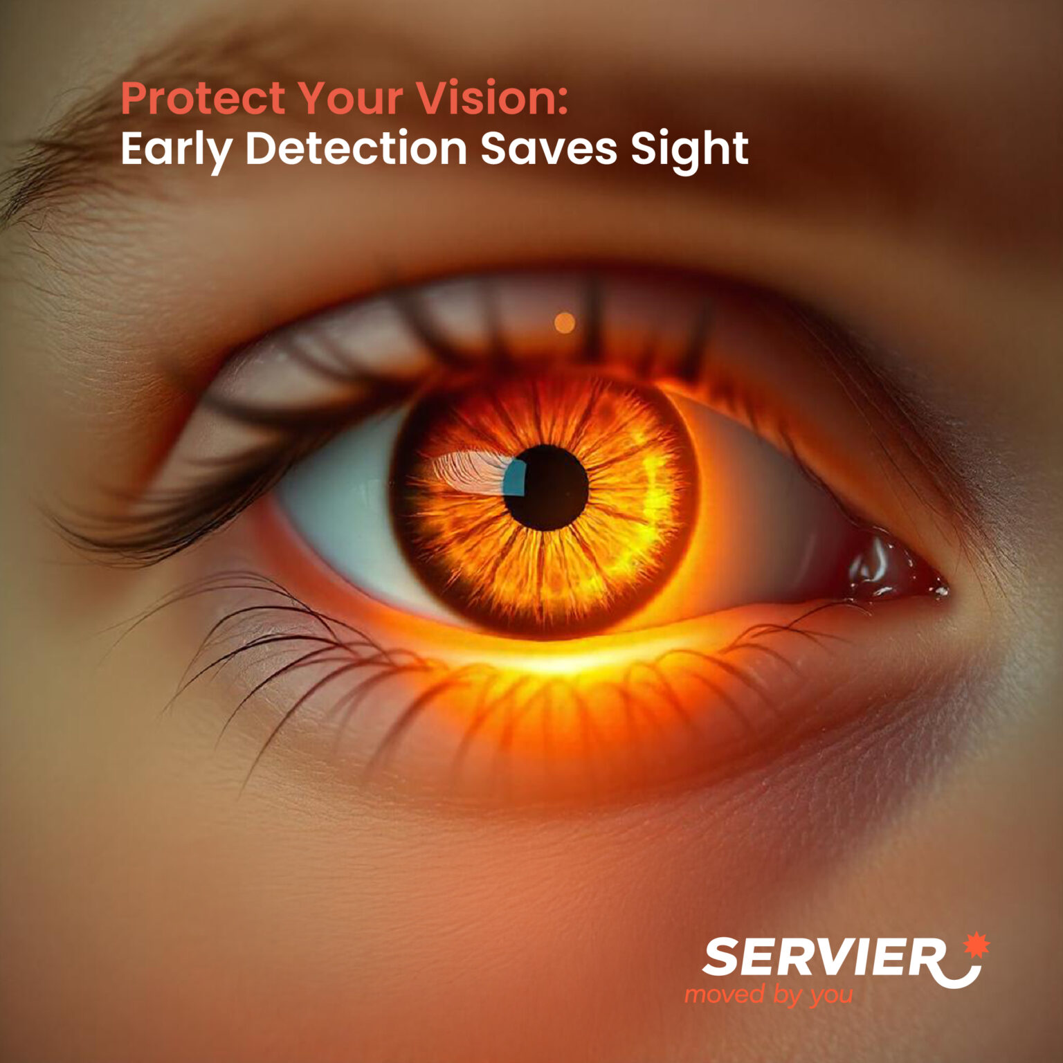 Glaucoma awareness month servier me