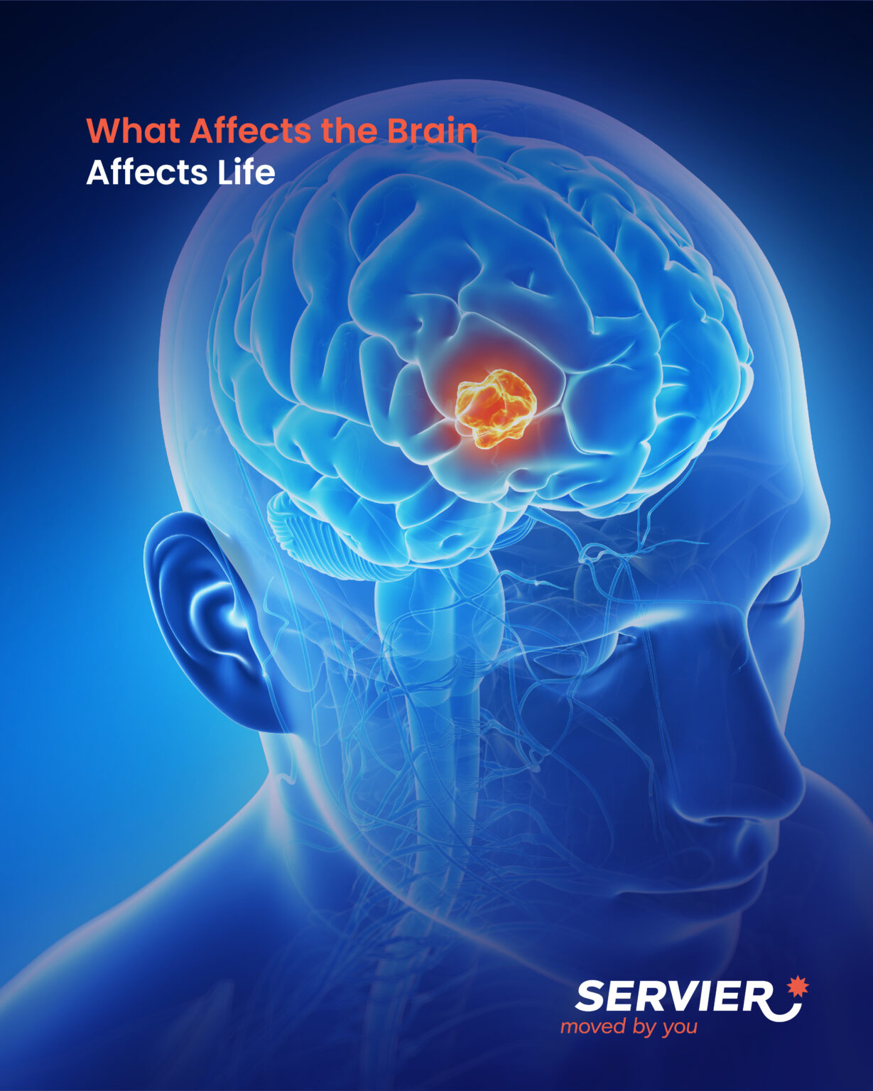 What Affects the Brain Affects Life. - Servier ME